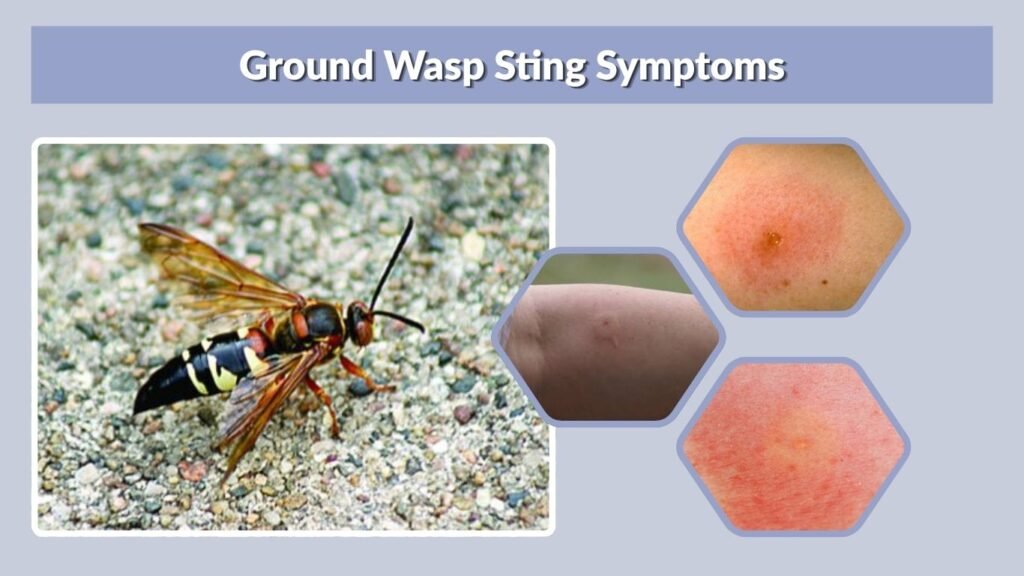 Ground Wasp Sting Symptoms
