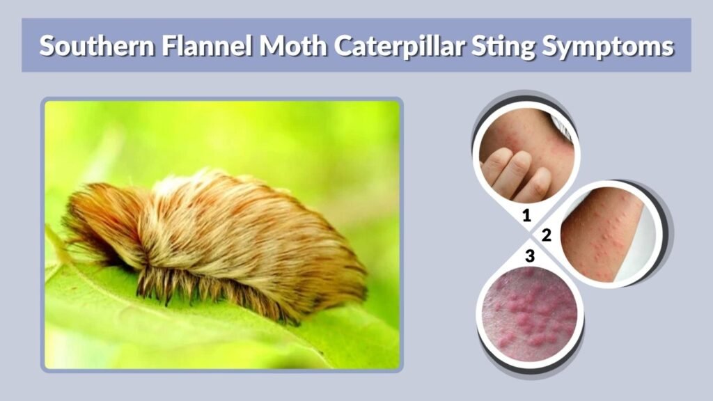 Southern Flannel Moth Caterpillar Sting Symptoms