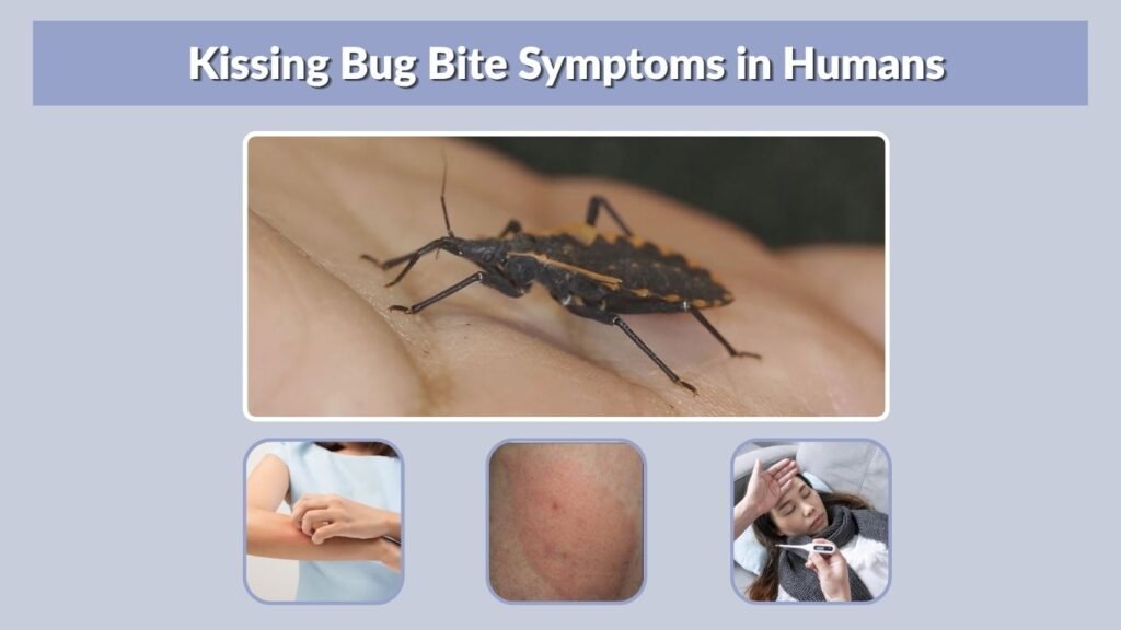 Kissing Bug Bite Symptoms in Humans