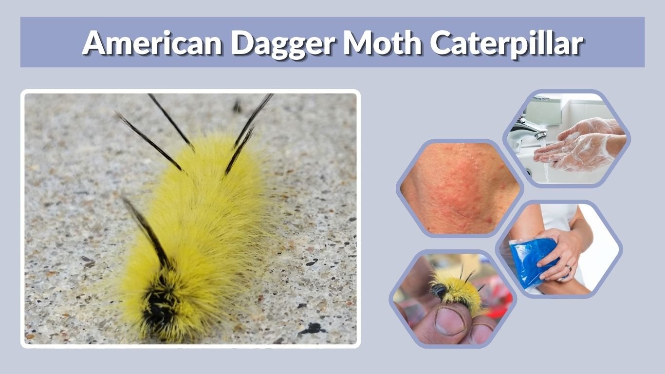 American Dagger Moth Caterpillar: Sting, Poison and ID Guide