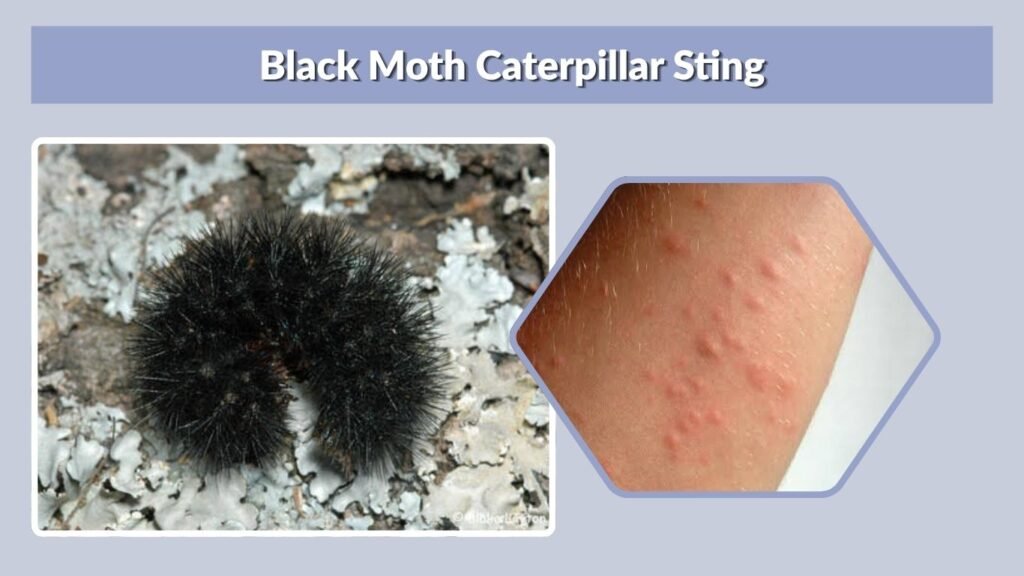 Black Moth Caterpillar Sting