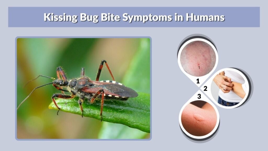 Kissing Bug Bite Symptoms in Humans