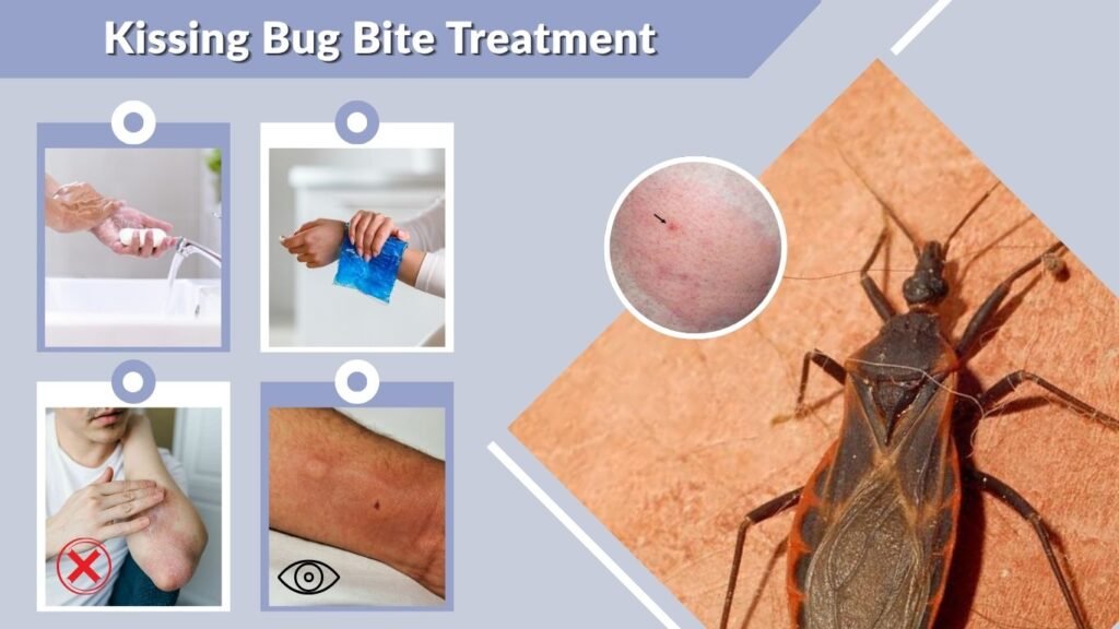 Kissing Bug Bite Treatment
