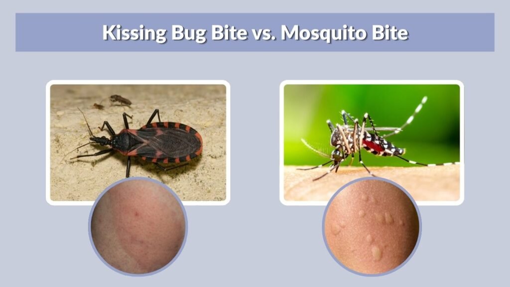 Kissing Bug Bite vs. Mosquito Bite