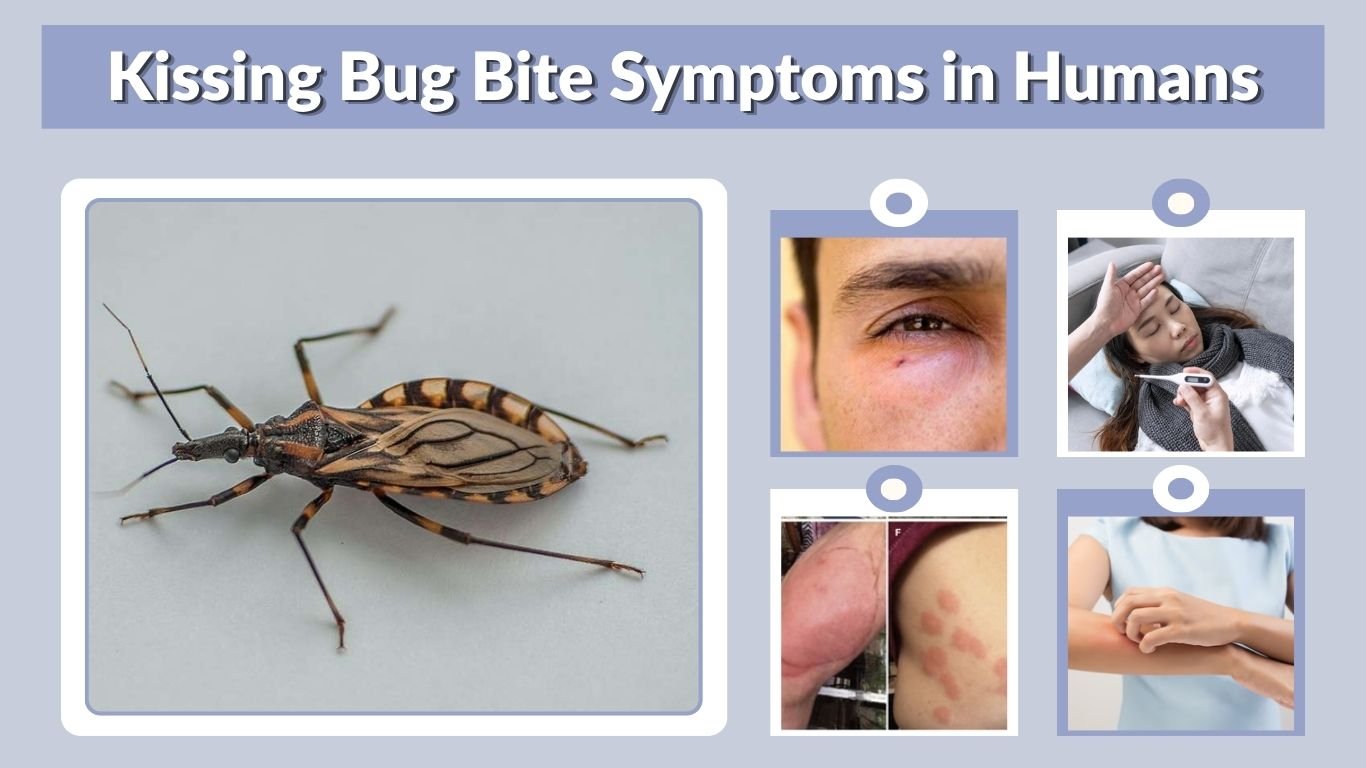 Kissing Bug Bite Symptoms in Humans: Signs and Risks