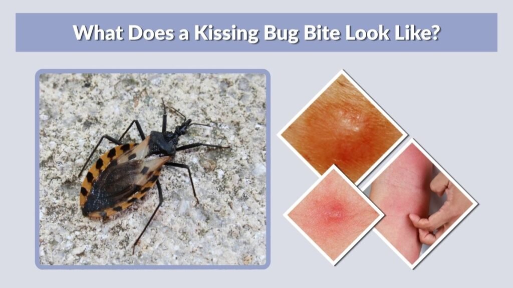 What Does a Kissing Bug Bite Look Like?