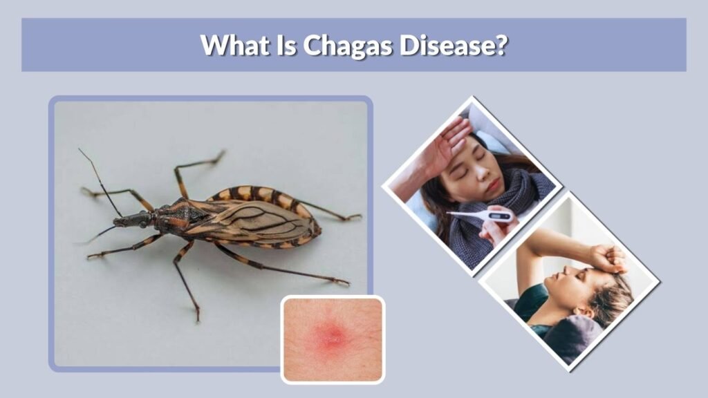What Is Chagas Disease?