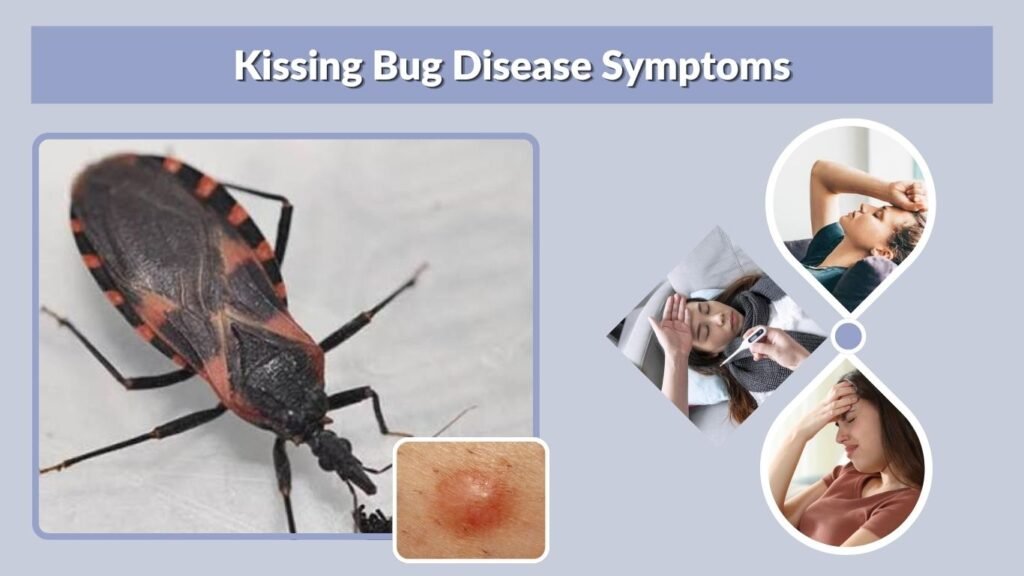 Kissing Bug Disease Symptoms