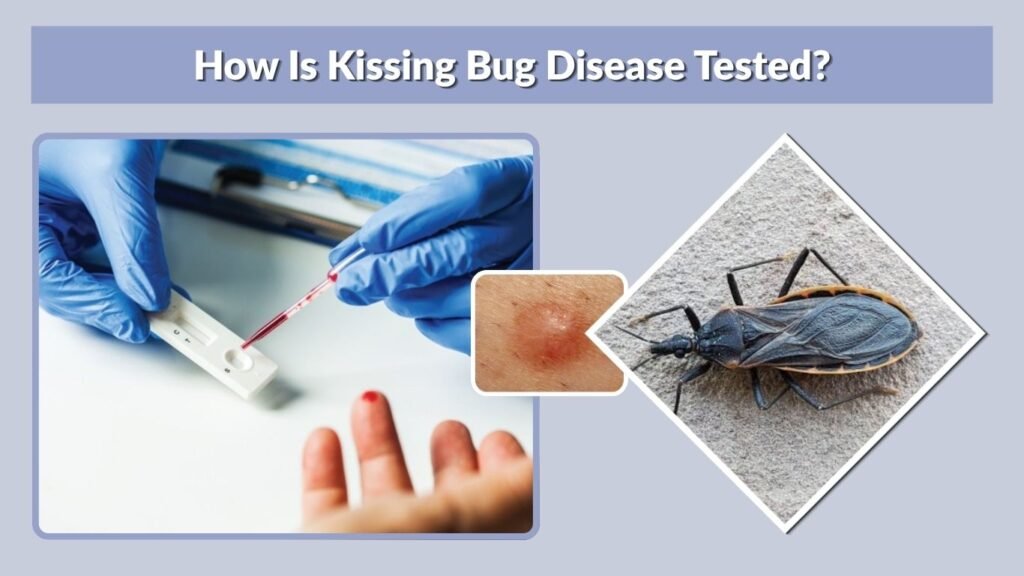 How Is Kissing Bug Disease Tested?