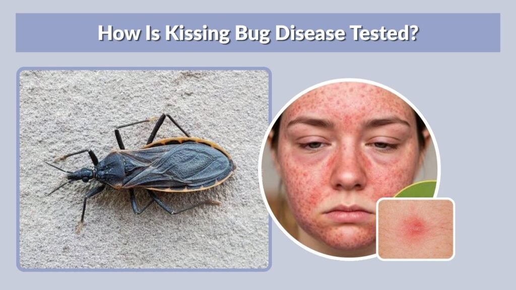Kissing Bug Disease in the United States