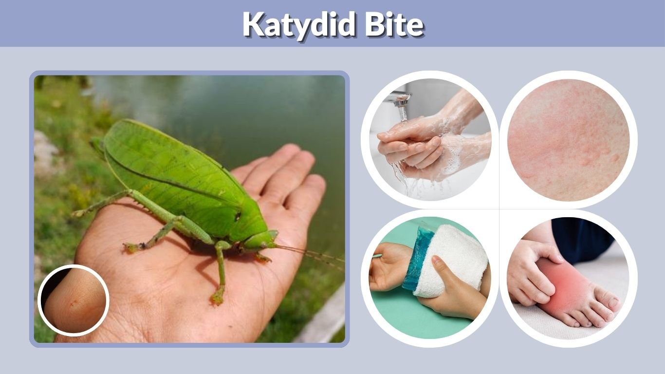 Katydid Bite: Does It Hurt, Symptoms, Marks & Treatment
