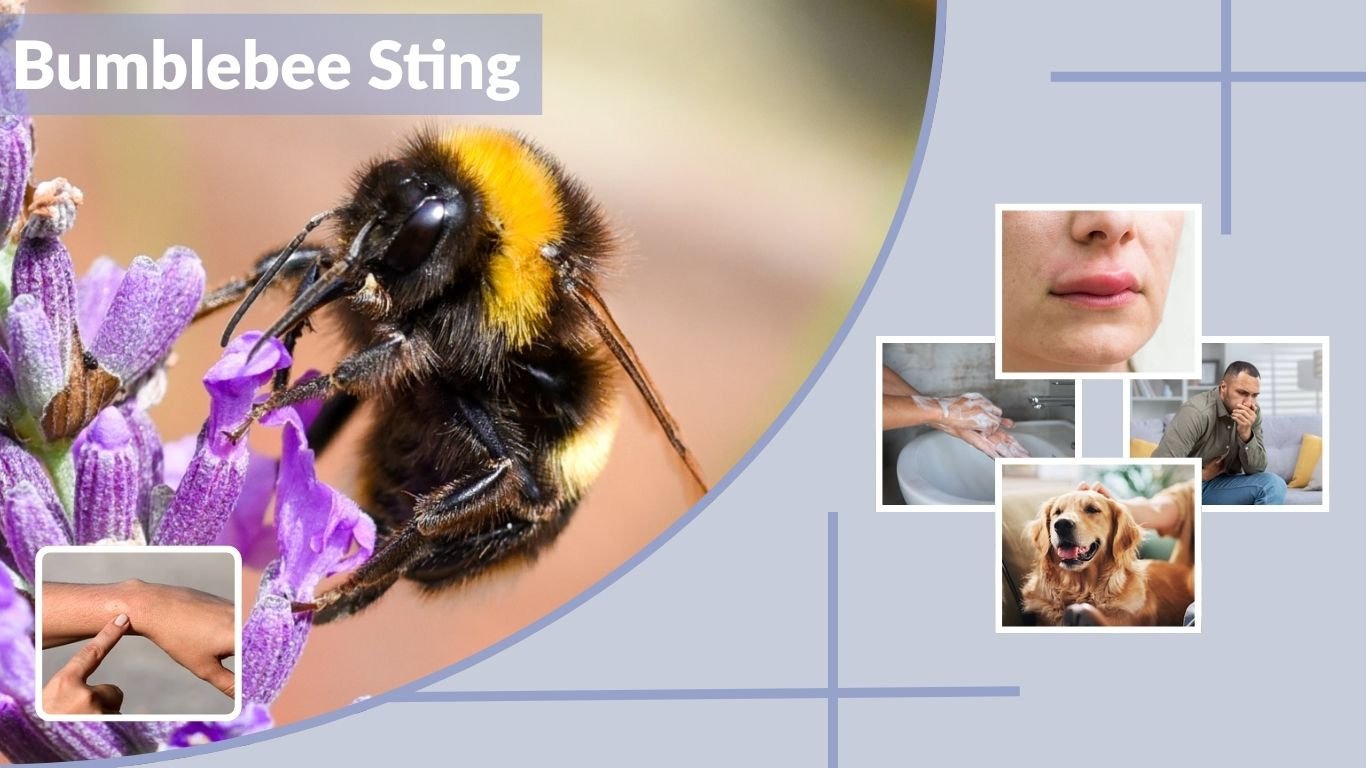 Bumblebee Sting: Symptoms, Treatment, and Allergy Signs