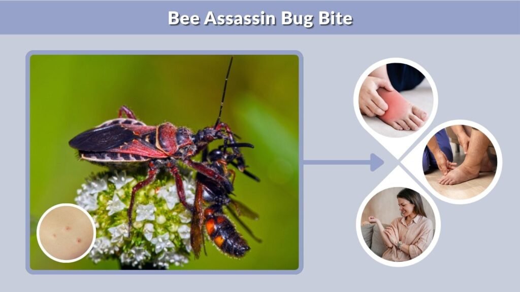 Bee Assassin Bug Bite