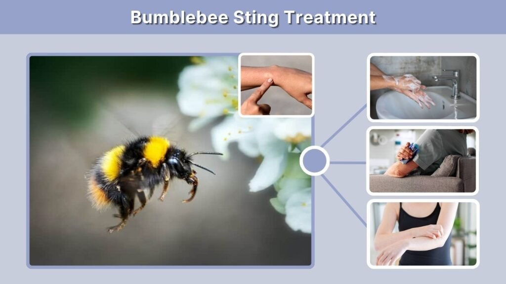 Bumblebee Sting Treatment