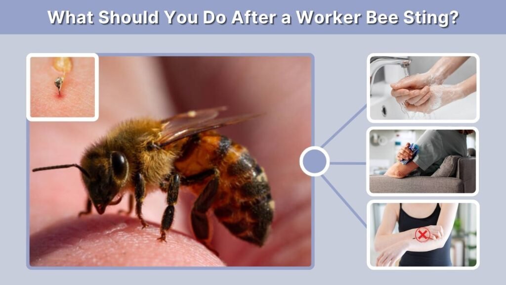 What Should You Do After a Worker Bee Sting?