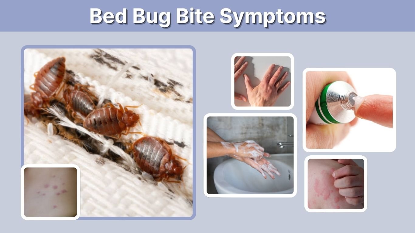 Bed Bug Bite Symptoms: Signs, Timeline, and Treatment