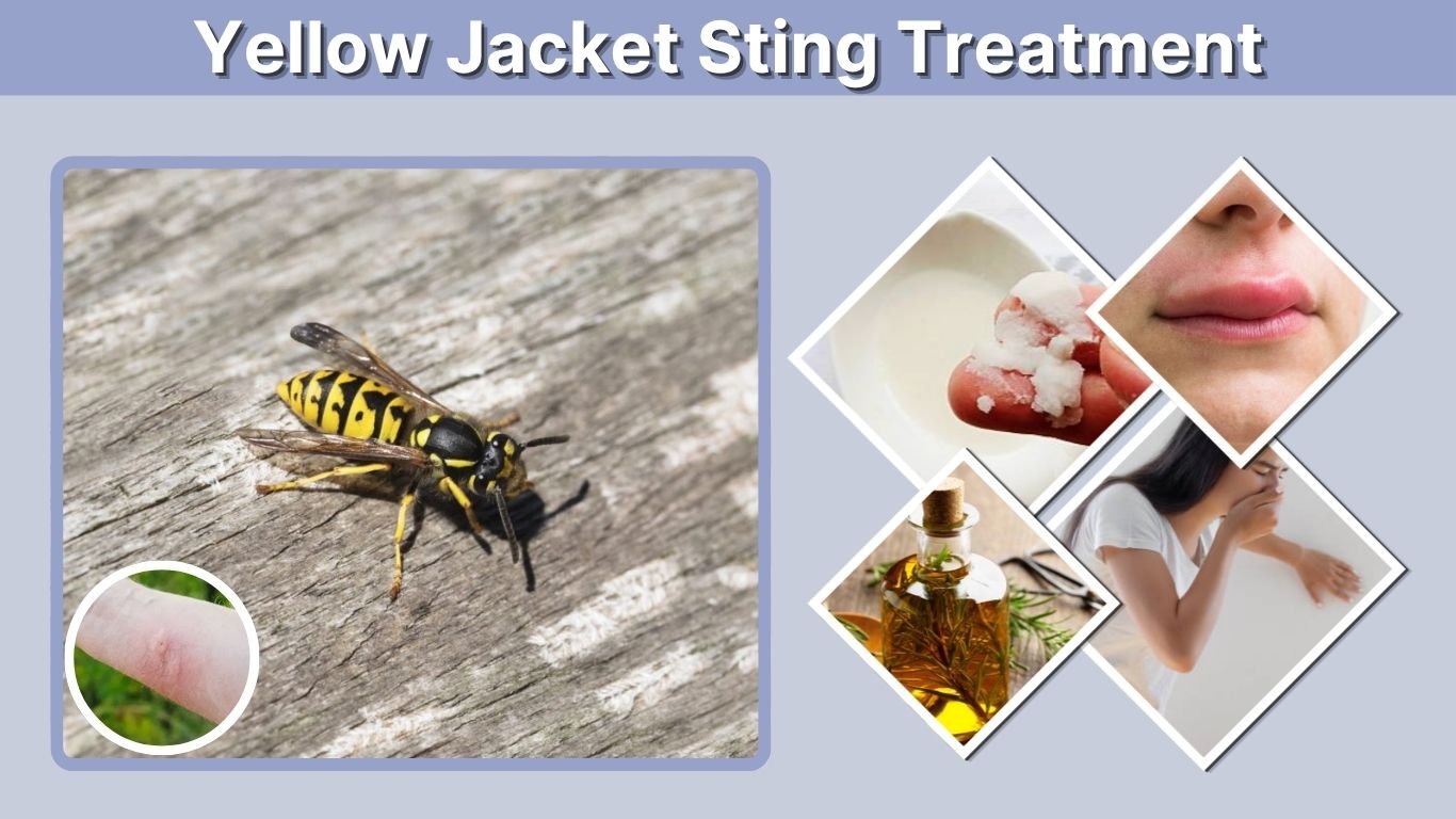 Yellow Jacket Sting Treatment: Relief, Swelling & Safety