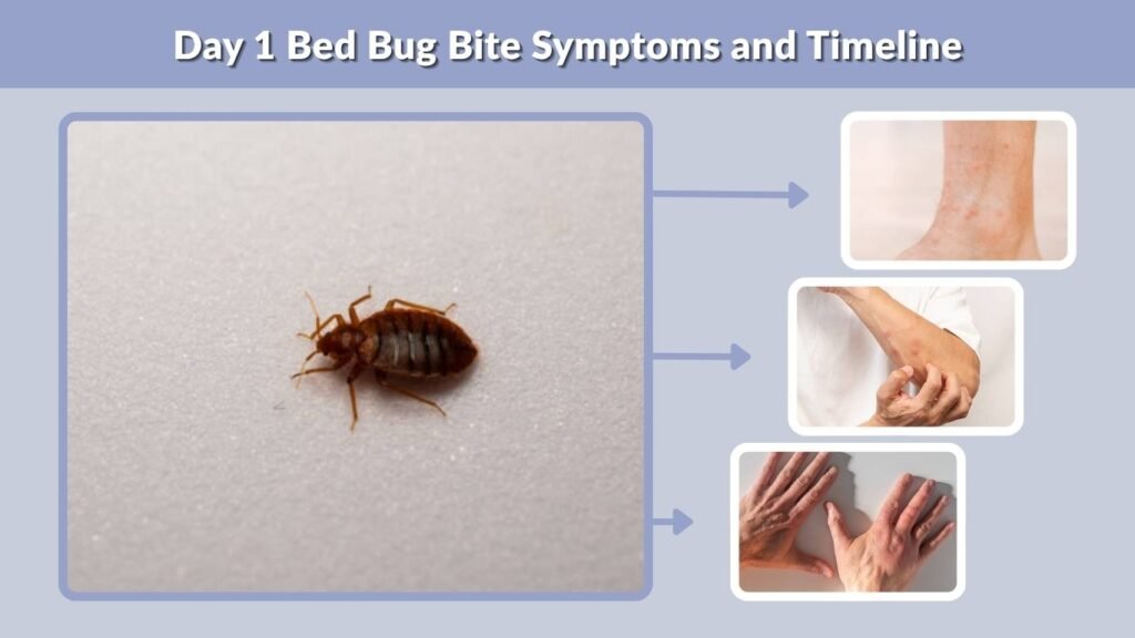 Day 1 Bed Bug Bite Symptoms and Timeline