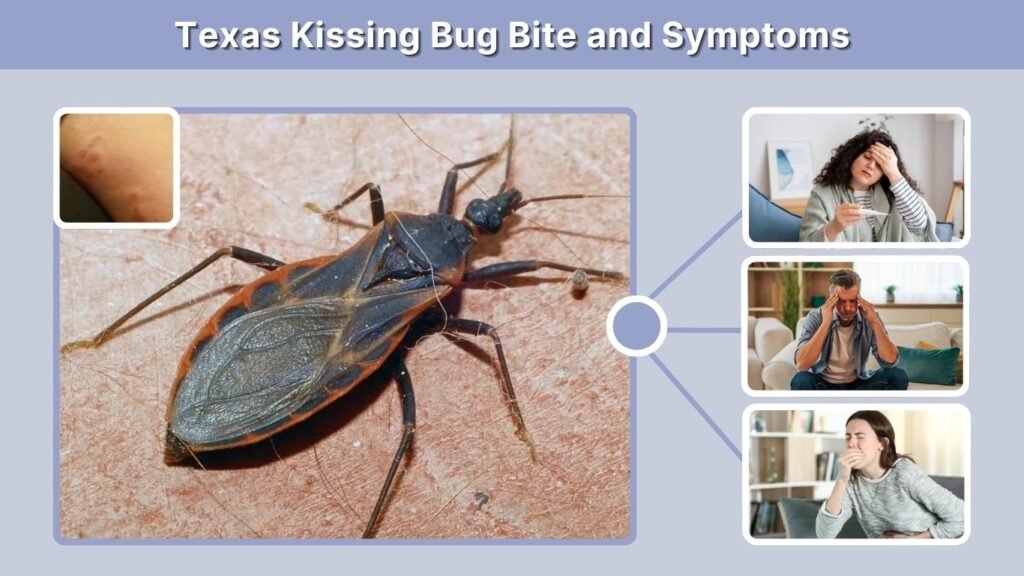 Texas Kissing Bug Bite and Symptoms