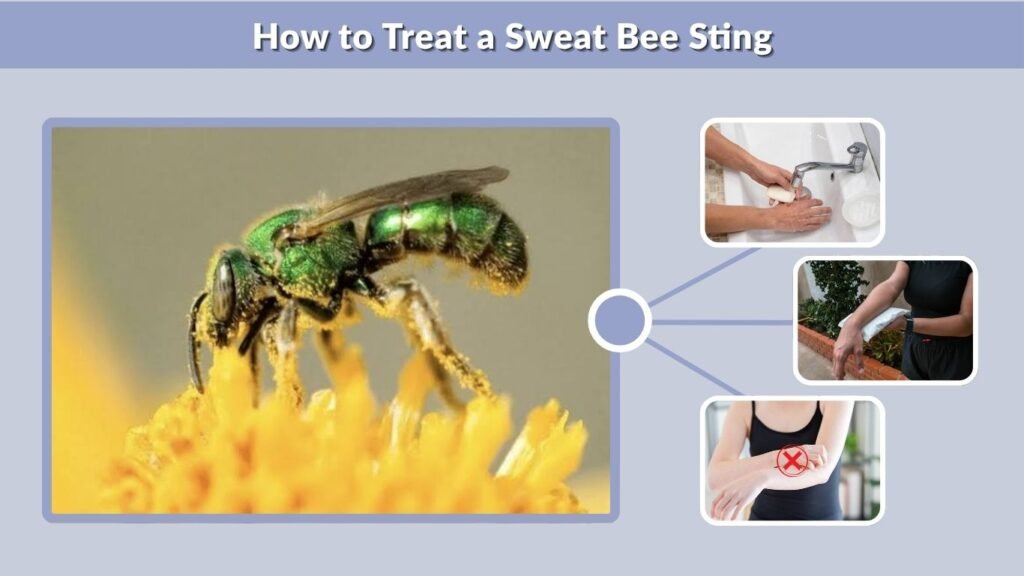 How to Treat a Sweat Bee Sting