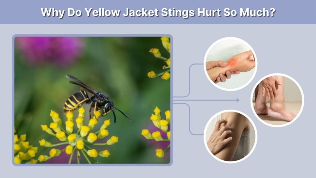 Why Do Yellow Jacket Stings Hurt So Much?