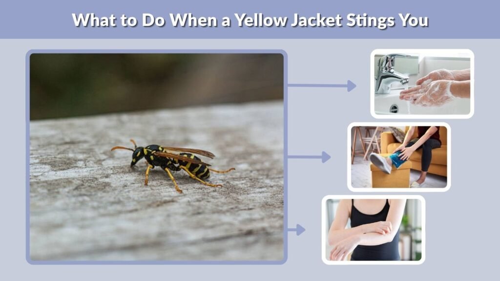 What to Do When a Yellow Jacket Stings You