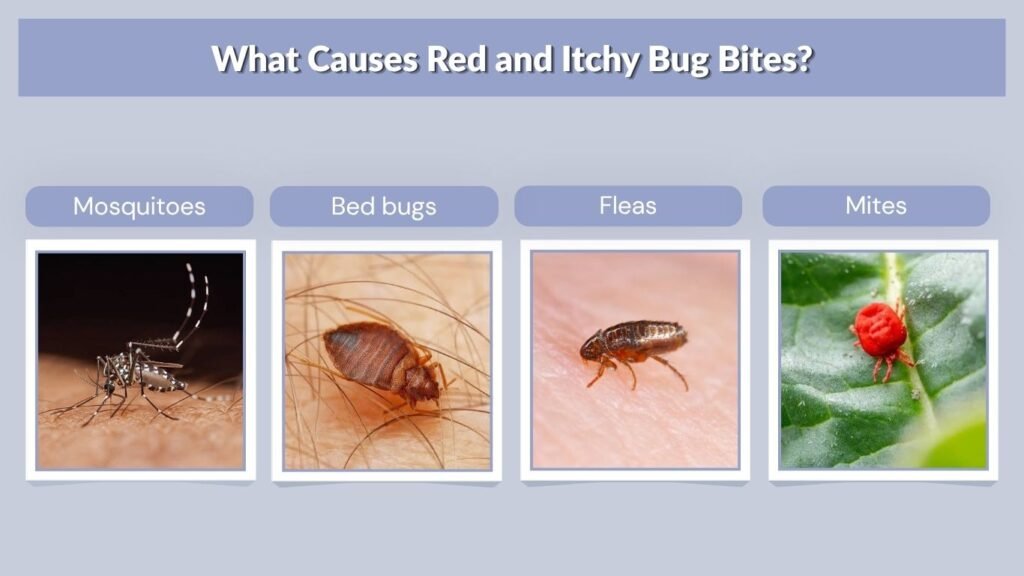 What Causes Red and Itchy Bug Bites?
