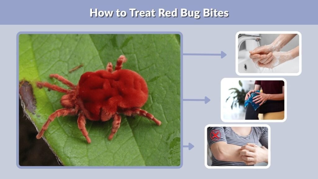 How to Treat Red Bug Bites