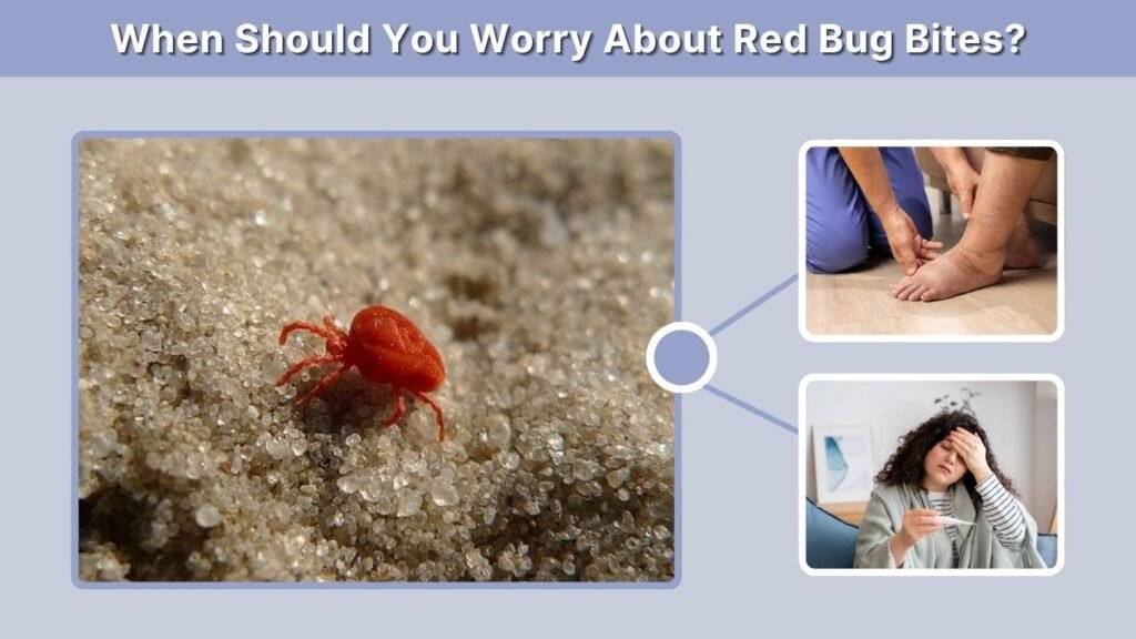 When Should You Worry About Red Bug Bites?