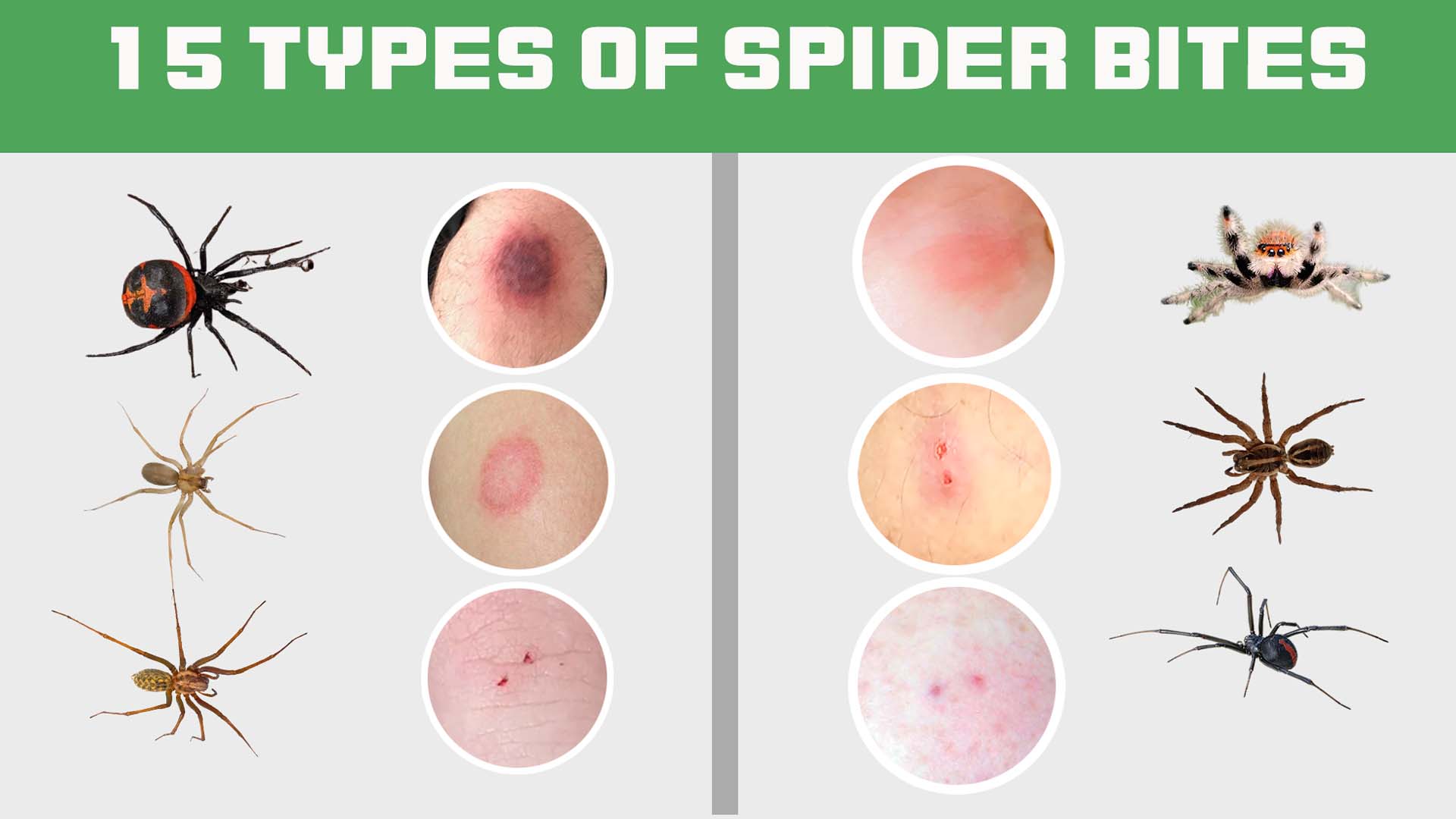 15 Types Of Spider Bites: Identification Chart with Picture