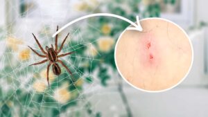 15 Types Of Spider Bites: Identification Chart with Picture