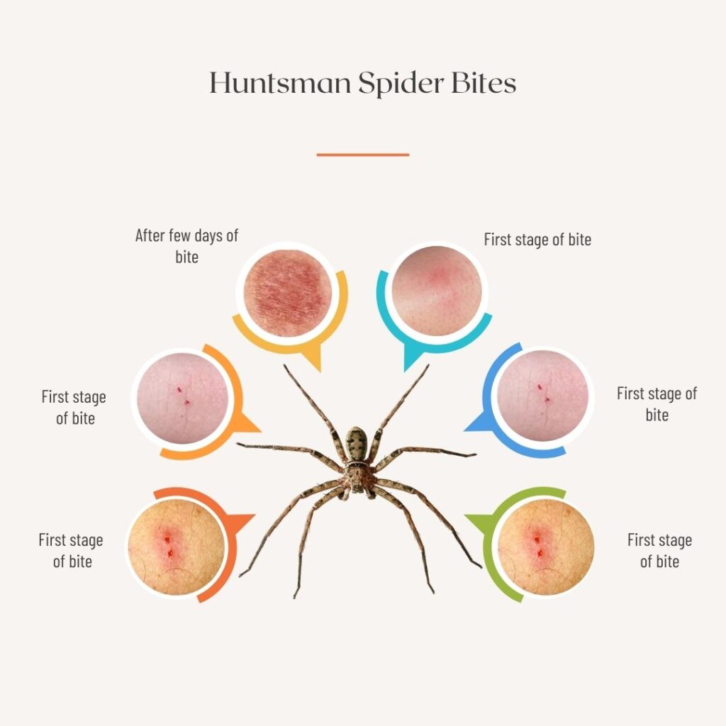 Huntsman Spider Bites