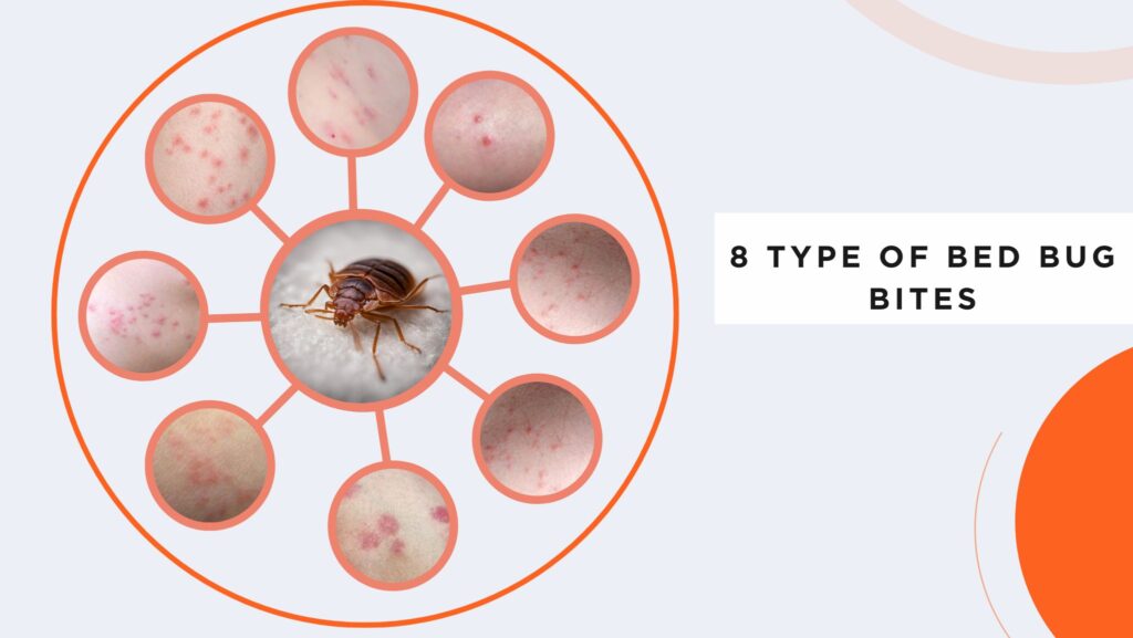 8 Type Of  Bed Bug Bites Identification Chart with Picture