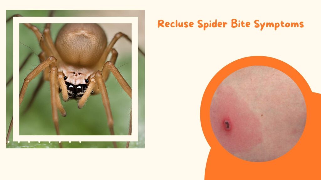 Recluse Spider Bite Symptoms