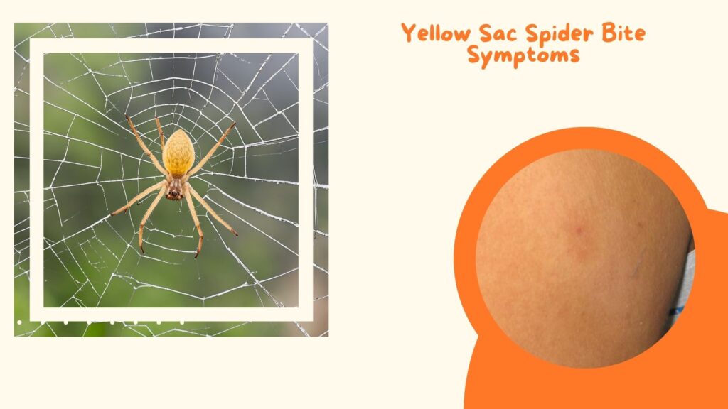 Recluse Spider Bite Symptoms