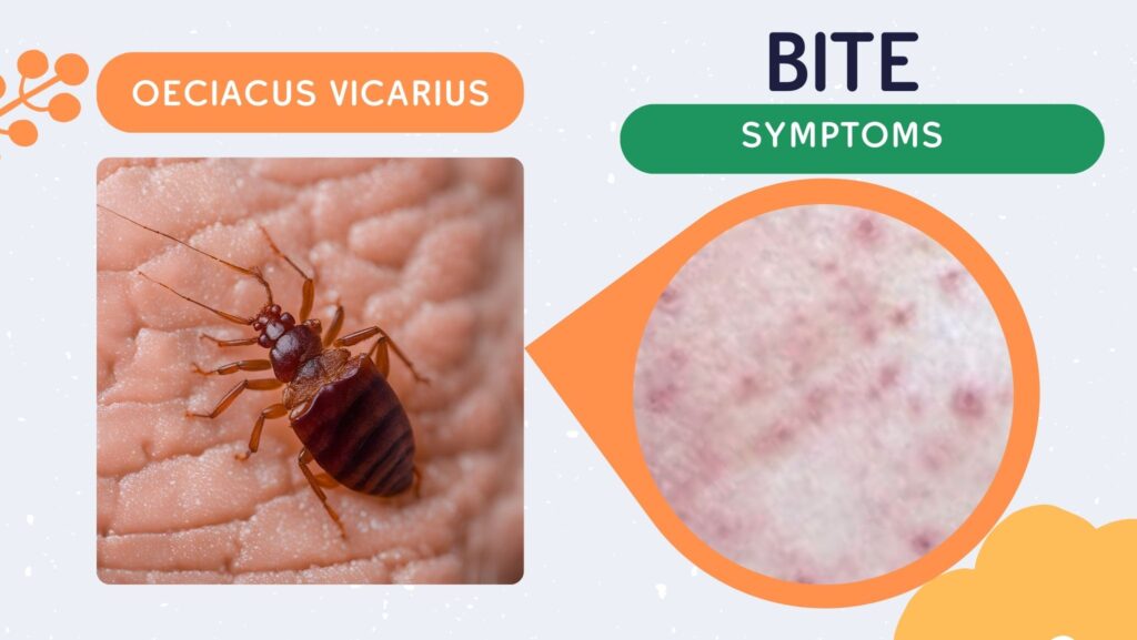 Bed Bug Bites