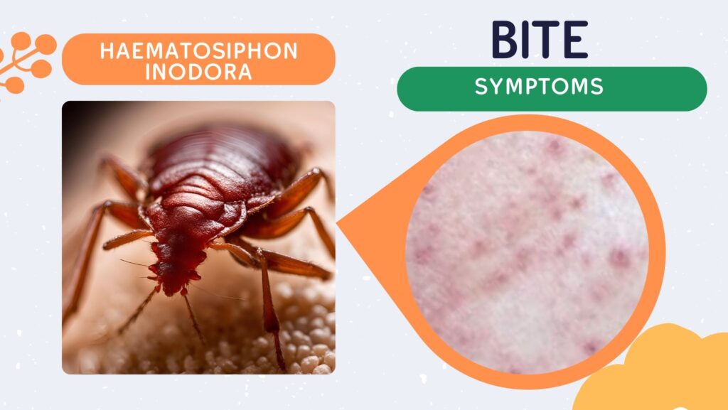 Bed Bug Bites