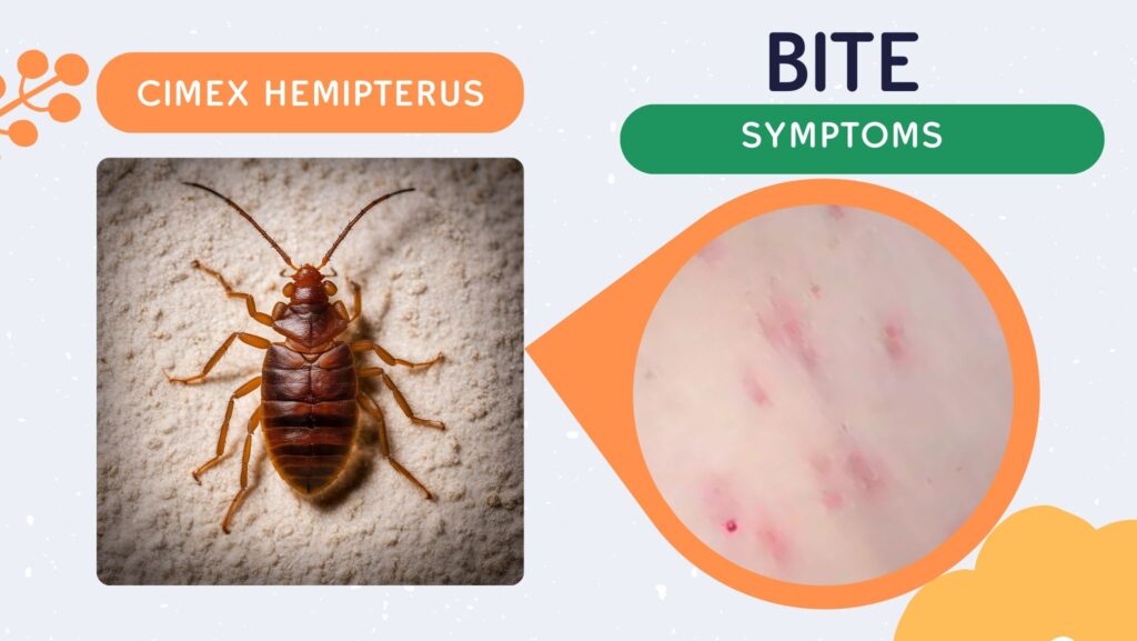 Bed Bug Bites 