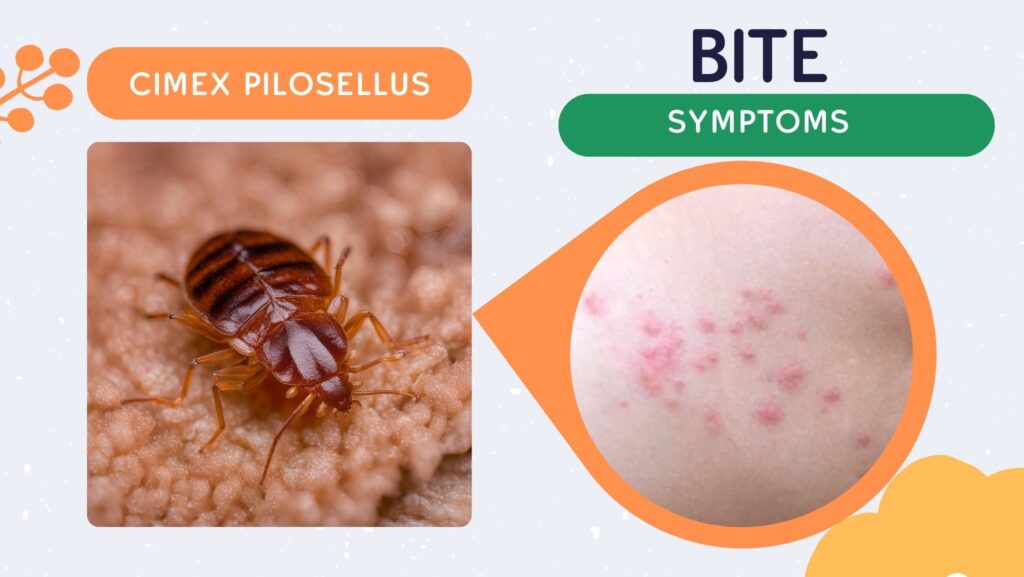 Bed Bug Bites