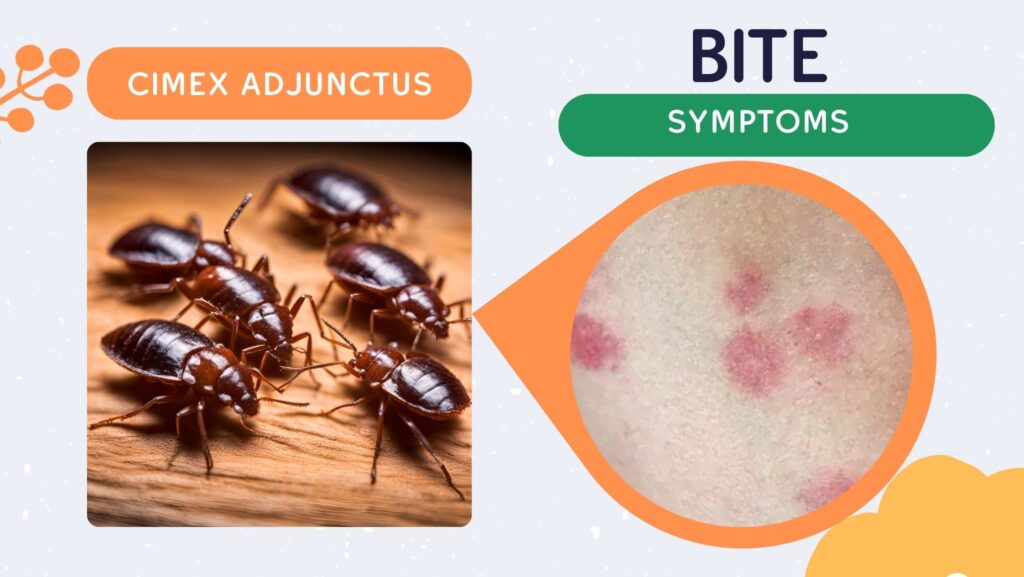 Bed Bug Bites