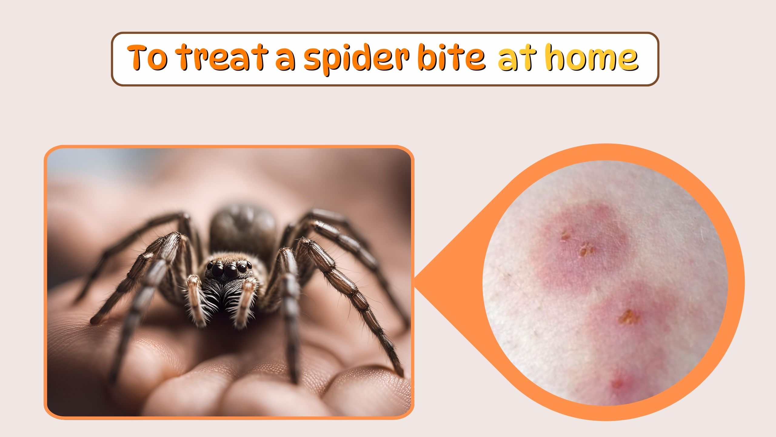 To treat a spider bite at home