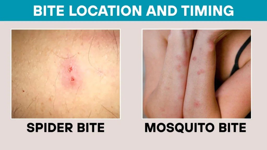 Bite Location and Timing