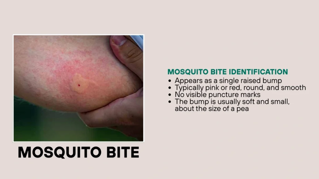 Mosquito Bite Identification