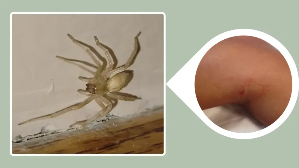 Yellow Sac Spider Bite Symptoms and Treatment