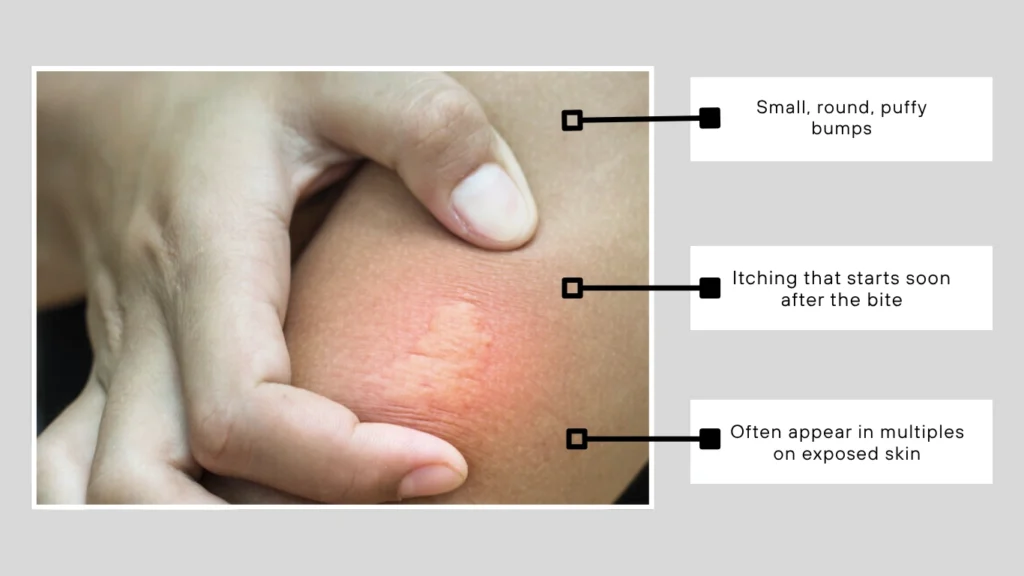 Common Biting Bugs and Their Bite Traits