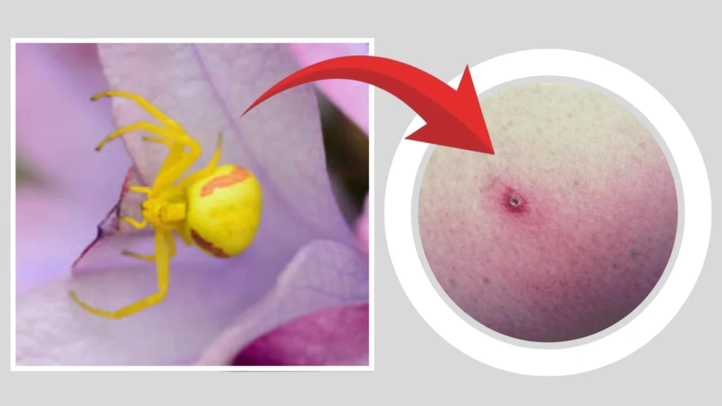 crab spiders FAQs About Biting & Safety