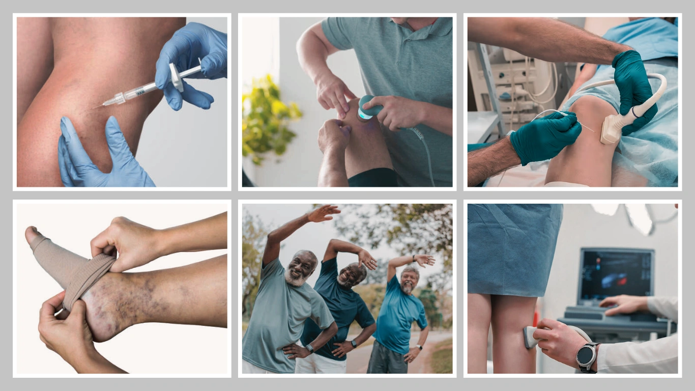 How to Get Rid of Spider Veins? 7 Effective Methods