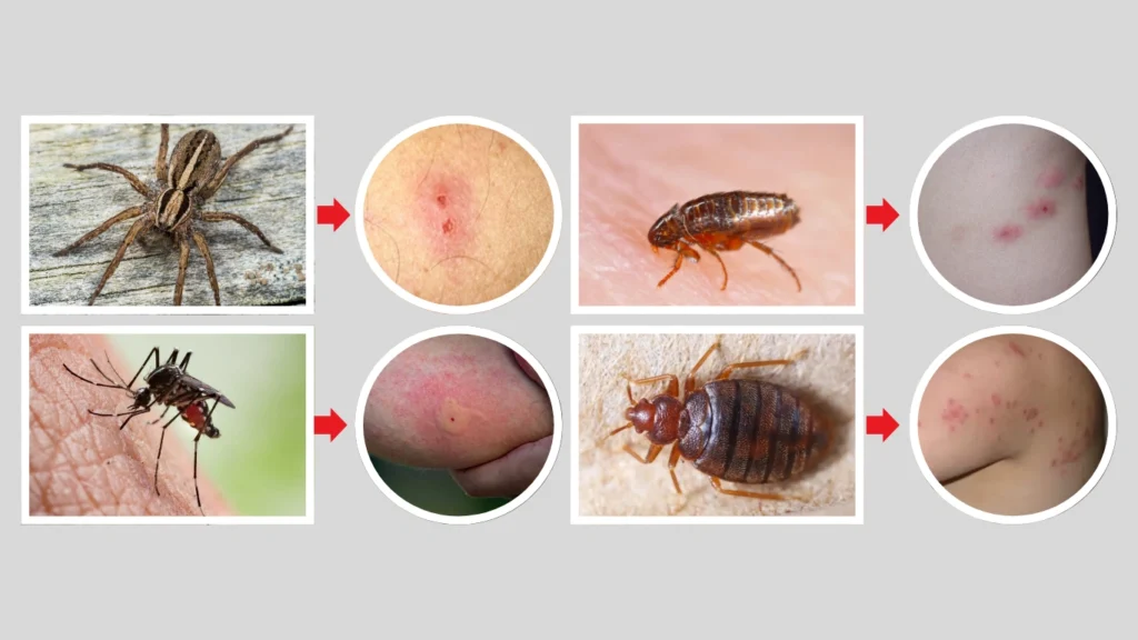 How to Identify the Bite Source
