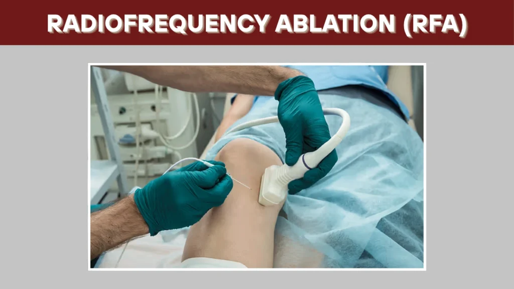 Radiofrequency Ablation (RFA)