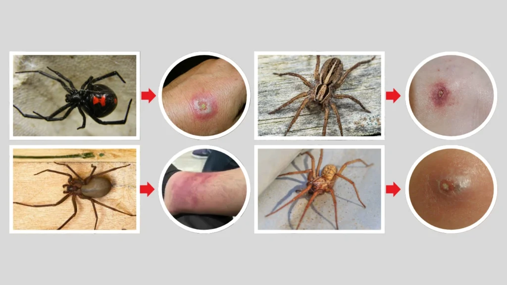 Types of Spiders That Bite Humans
